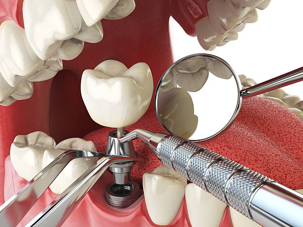 Best 24-Hour Emergency Dentist in Clemson University, SC